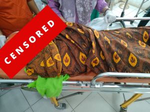 Siswi SMP di Batanghari Tewas Usai Berkelahi