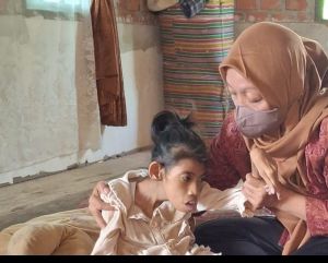 Anak Usia 18 Tahun di Jambi Derita Gizi Buruk, Sang Ibunda Hanya Bisa Pasrah